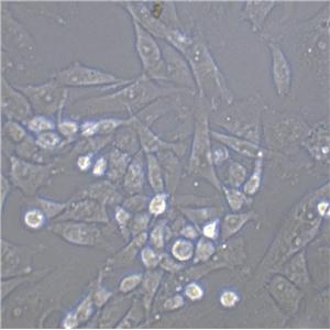 RS1 Cell:大鼠皮肤成纤维样细胞系