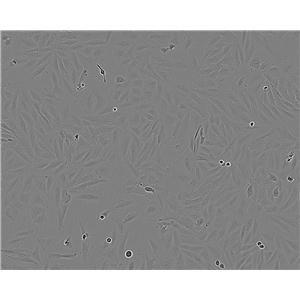 FL83B Cell:小鼠正常肝细胞系