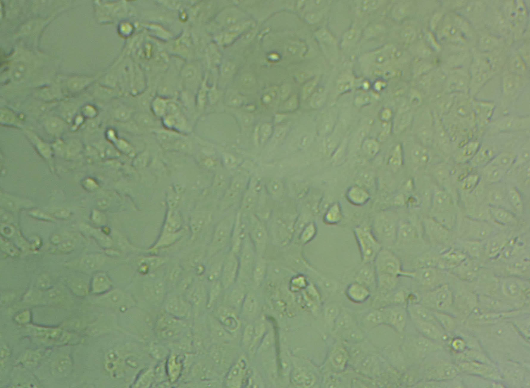 B35 Cell:大鼠神经母细胞瘤细胞系,B35 Cell