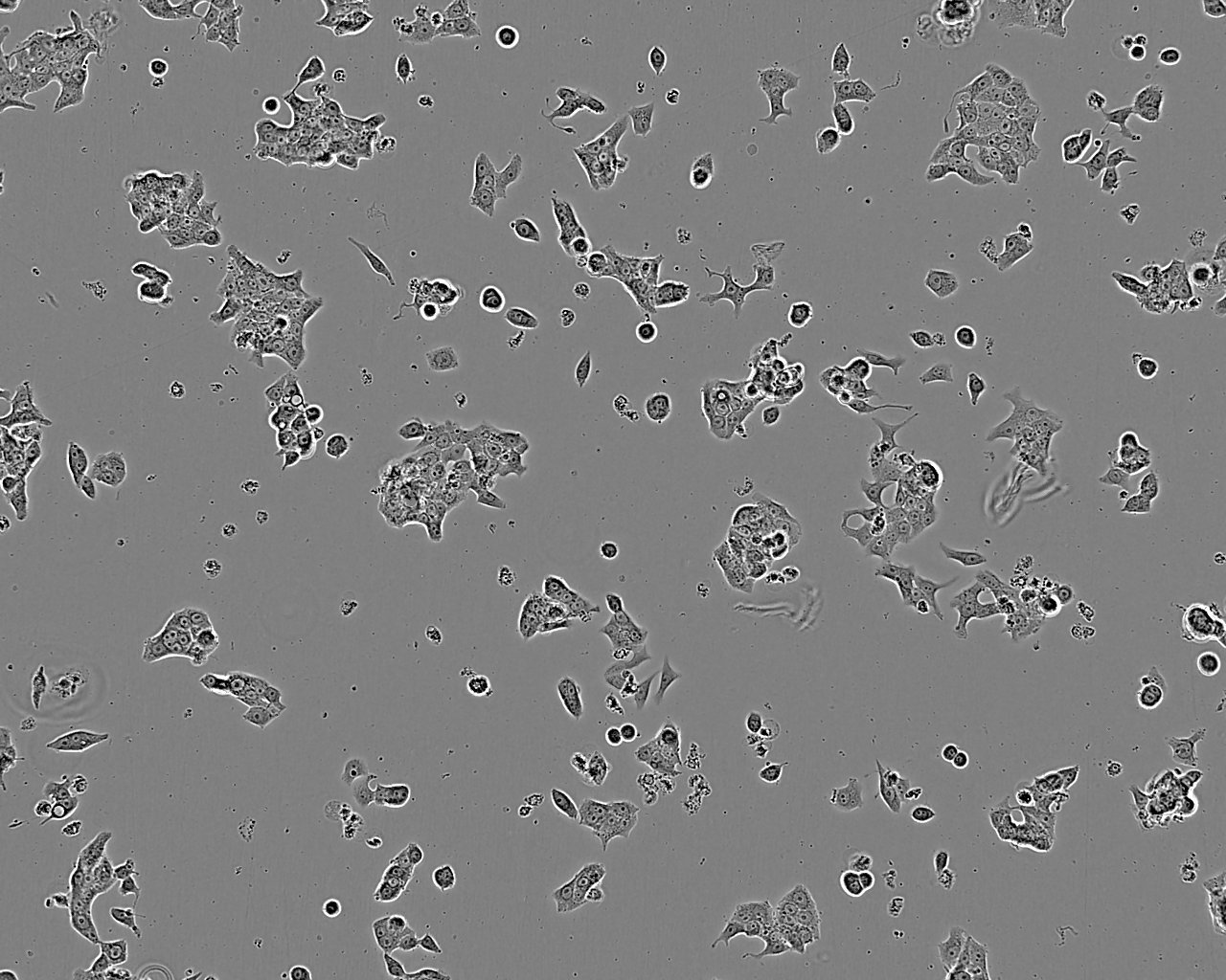 HCC1588 Cell:人肺鳞癌细胞系,HCC1588 Cell