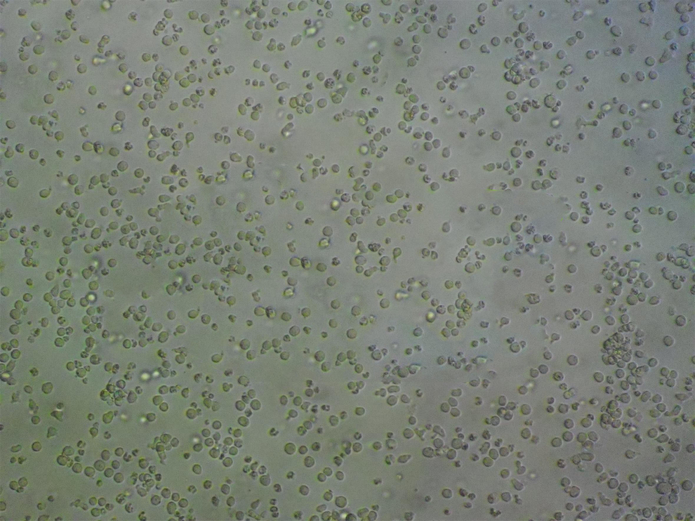 HT Cell:人混合淋巴瘤细胞系,HT Cell