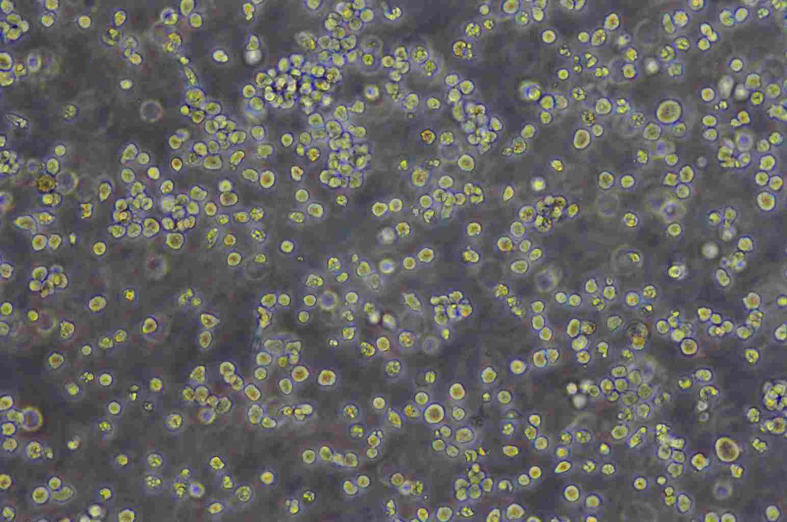 MC116 Cell:人(未分化的)淋巴瘤细胞系,MC116 Cell