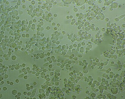 KCL-22 Cell:人慢性粒细胞白血病细胞系,KCL-22 Cell