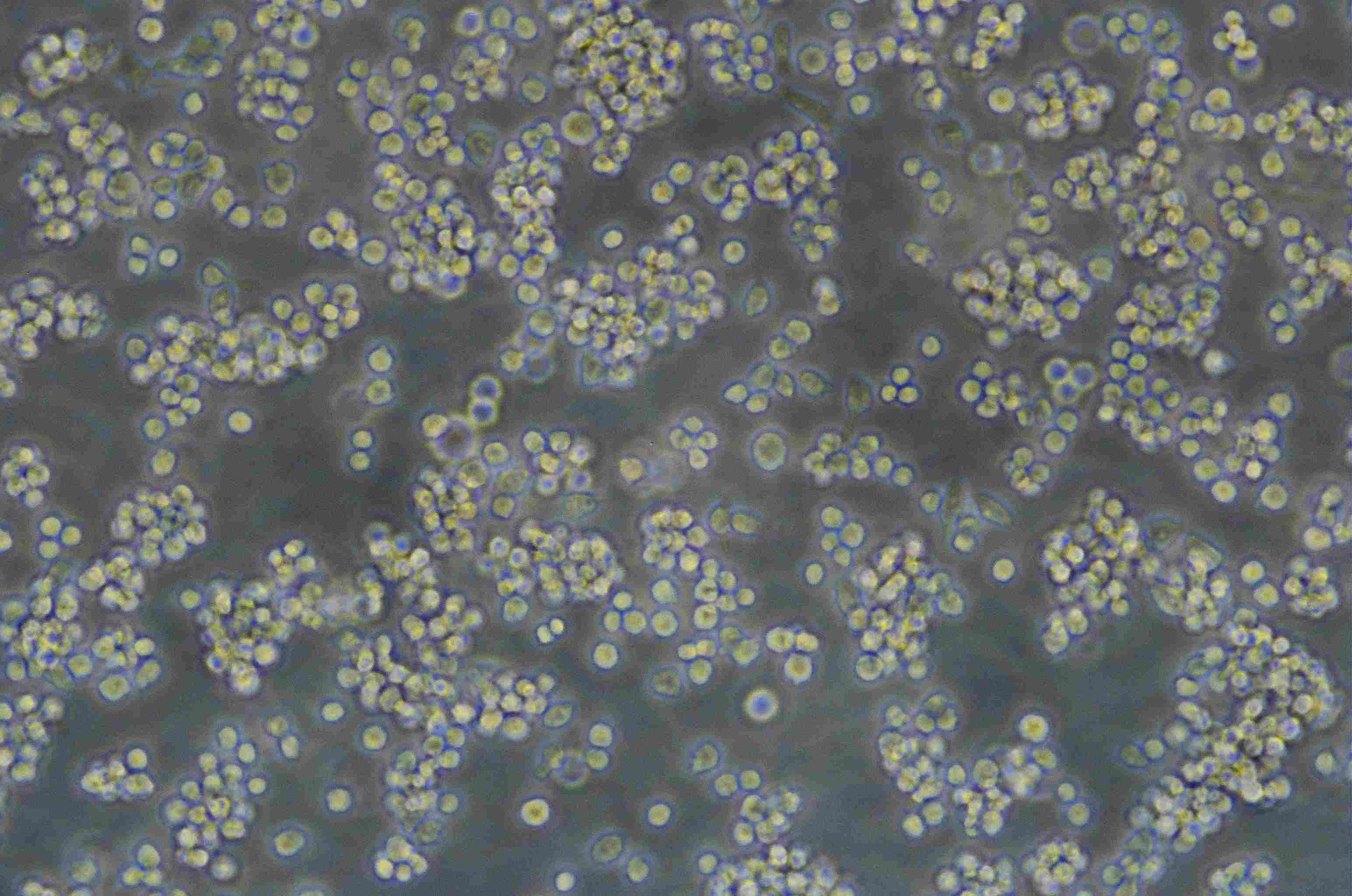 HuT 78 Cell:人T淋巴瘤细胞系,HuT 78 Cell