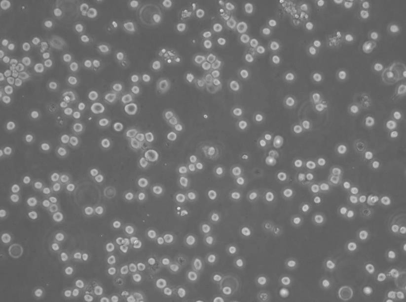 MDCC-MSB1 Cell:鸡淋巴瘤细胞系,MDCC-MSB1 Cell