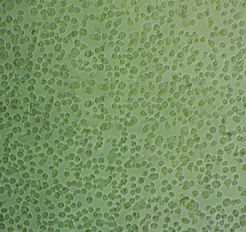 OCI-Ly18 Cell:人弥漫大B细胞淋巴瘤细胞系,OCI-Ly18 Cell