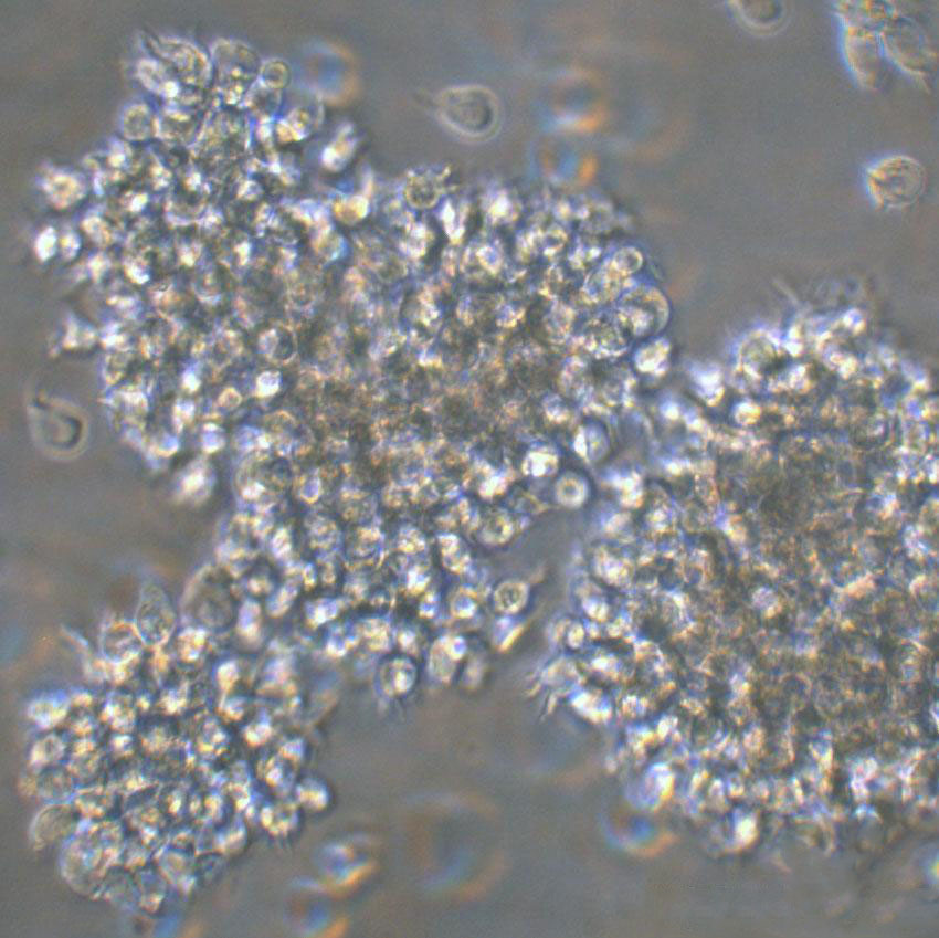 ME-1 [Human leukemia] Cell:人類急性髓系白血病細(xì)胞系,ME-1 [Human leukemia] Cell