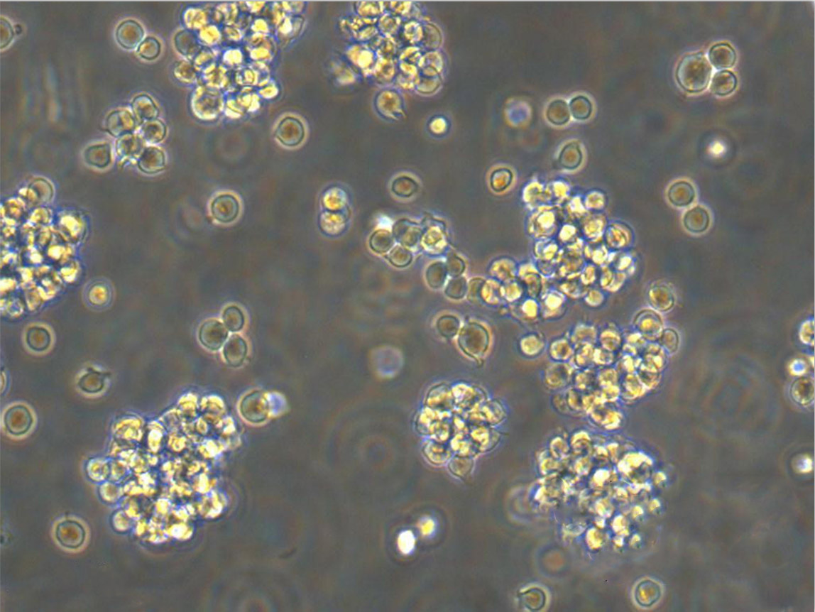 1301 Cell:人急性T淋巴細胞白血病細胞系,1301 Cell