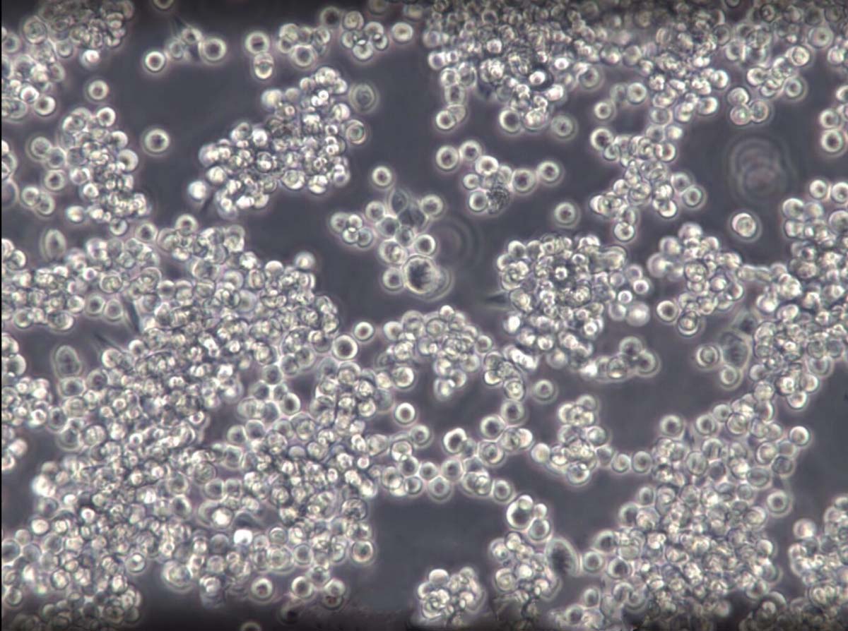 L-540 Cell:人霍奇金淋巴瘤细胞系,L-540 Cell