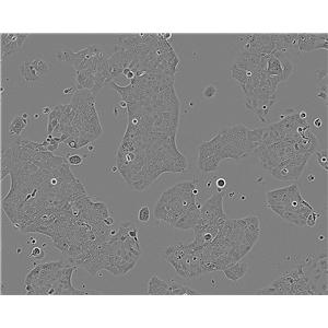 ND7/23 Cell:鼠神经母细胞瘤细胞系