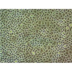 SG231 Cell:人胆管上皮癌细胞系