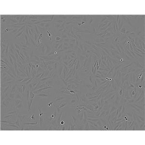 KYSE-180 Cell:人食管鳞癌细胞系