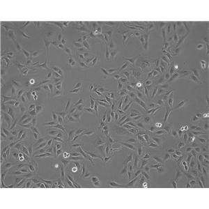 EAC-E2G8 Cell:小鼠腹水瘤细胞系