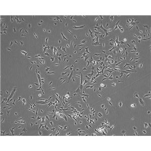 RIN-m5F Cell:大鼠胰岛β细胞瘤细胞系