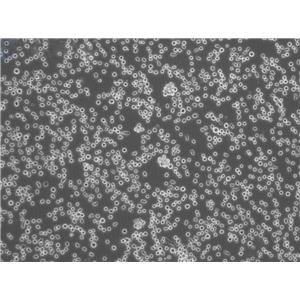 SNK-6 Cell:人NK/T细胞淋巴瘤细胞系