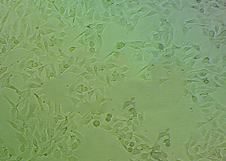 CNE-2 epithelioid cells人鼻咽癌细胞系,CNE-2 epithelioid cells