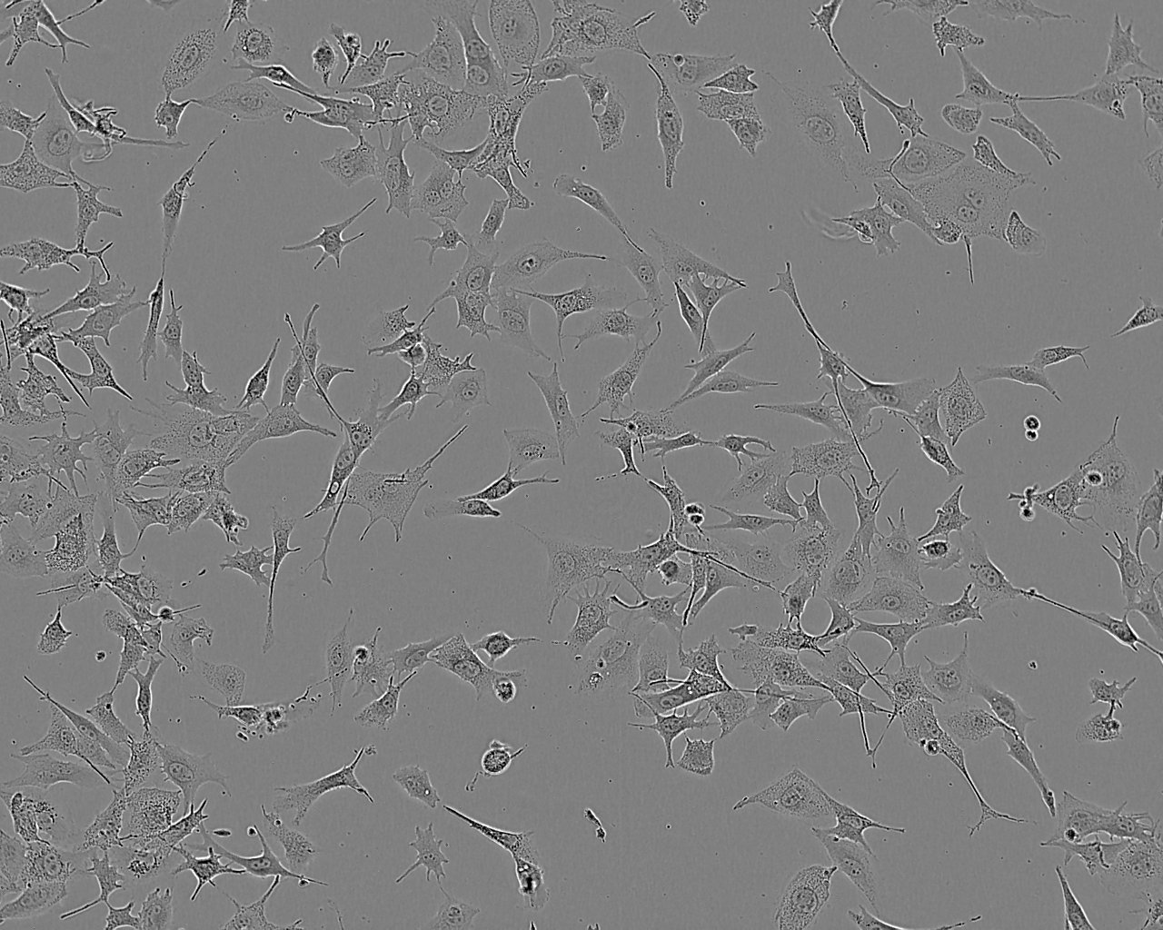 DLD-1 epithelioid cells人結(jié)直腸腺癌上皮細胞系,DLD-1 epithelioid cells