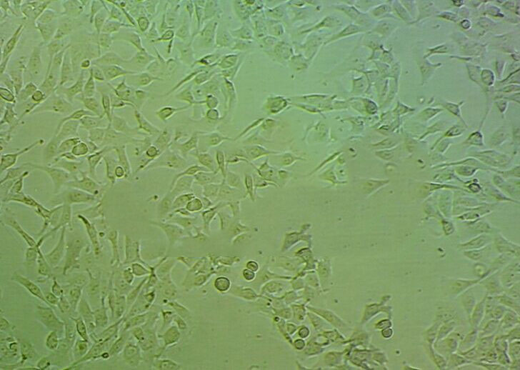 PLA-801D epithelioid cells人高转移肺癌细胞系,PLA-801D epithelioid cells