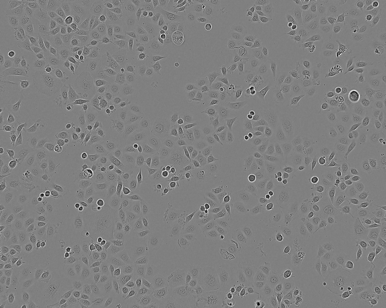 NCI-H358 epithelioid cells人非小细胞肺癌细胞系,NCI-H358 epithelioid cells