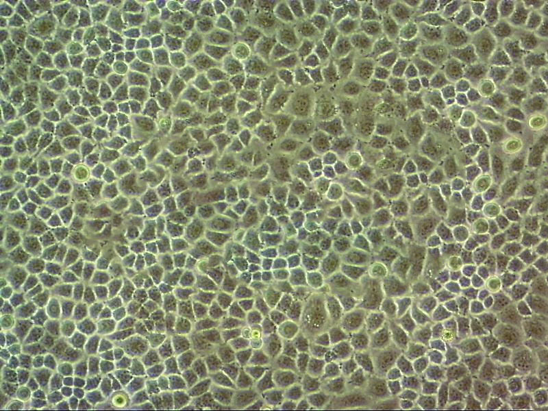 HCC827 epithelioid cells人非小细胞肺癌细胞系,HCC827 epithelioid cells