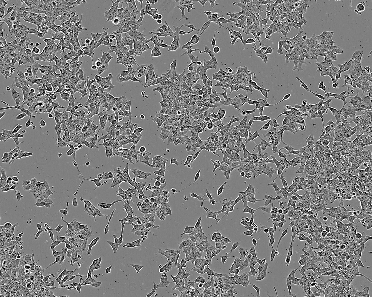 NCI-H460 epithelioid cells人大细胞肺癌细胞系,NCI-H460 epithelioid cells