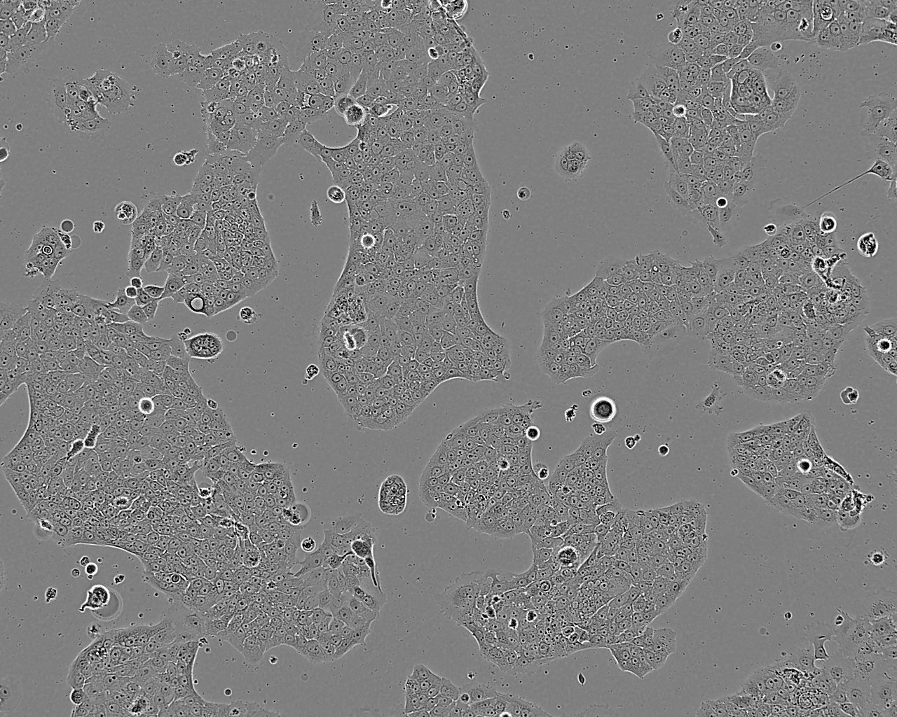 MeT-5A epithelioid cells人膜間皮細(xì)胞系,MeT-5A epithelioid cells