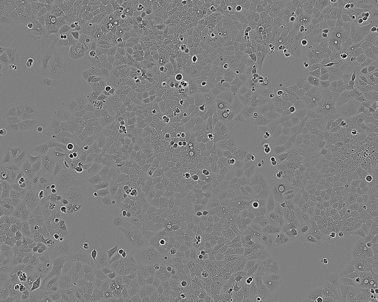 PLC/PRF/5 epithelioid cells人肝癌亚力山大细胞系,PLC/PRF/5 epithelioid cells