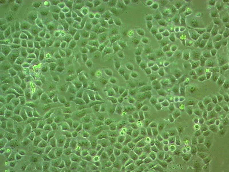 SNU-398 epithelioid cells人肝癌細胞系,SNU-398 epithelioid cells