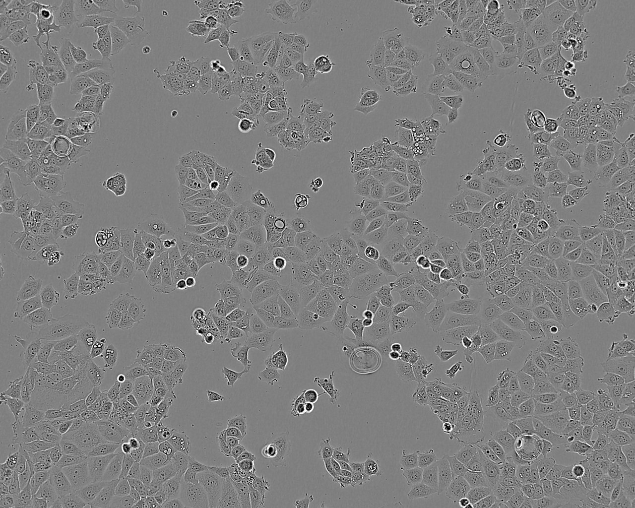 QGY-7703 epithelioid cells人肝癌细胞系,QGY-7703 epithelioid cells