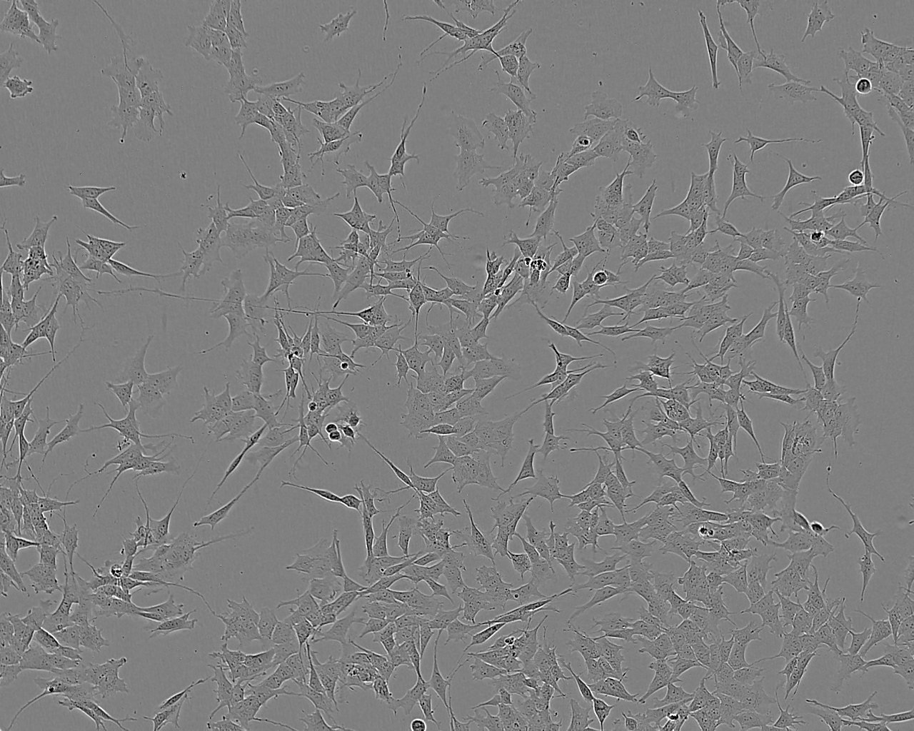 Huh-7 epithelioid cells人肝癌细胞系,Huh-7 epithelioid cells