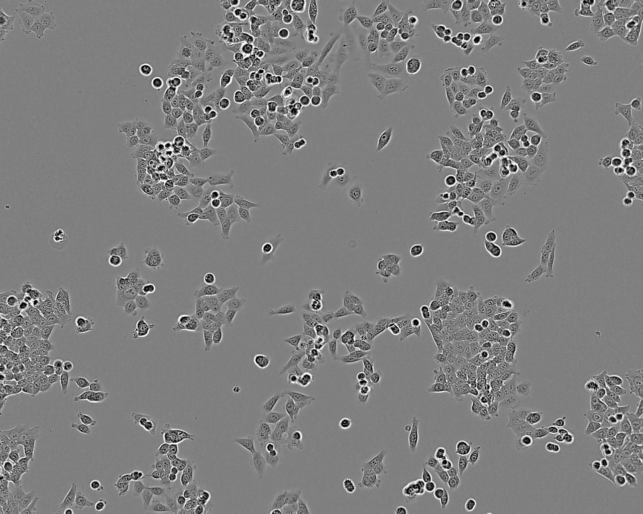 NCI-H520 epithelioid cells人肺腺鳞癌细胞系,NCI-H520 epithelioid cells