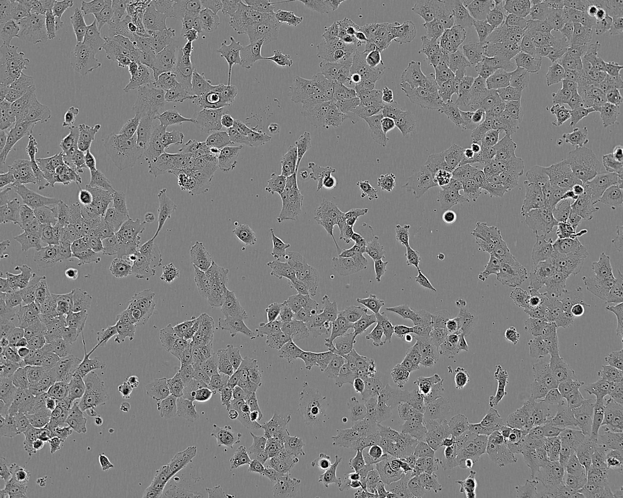 PC-9 epithelioid cells人肺腺癌细胞系,PC-9 epithelioid cells