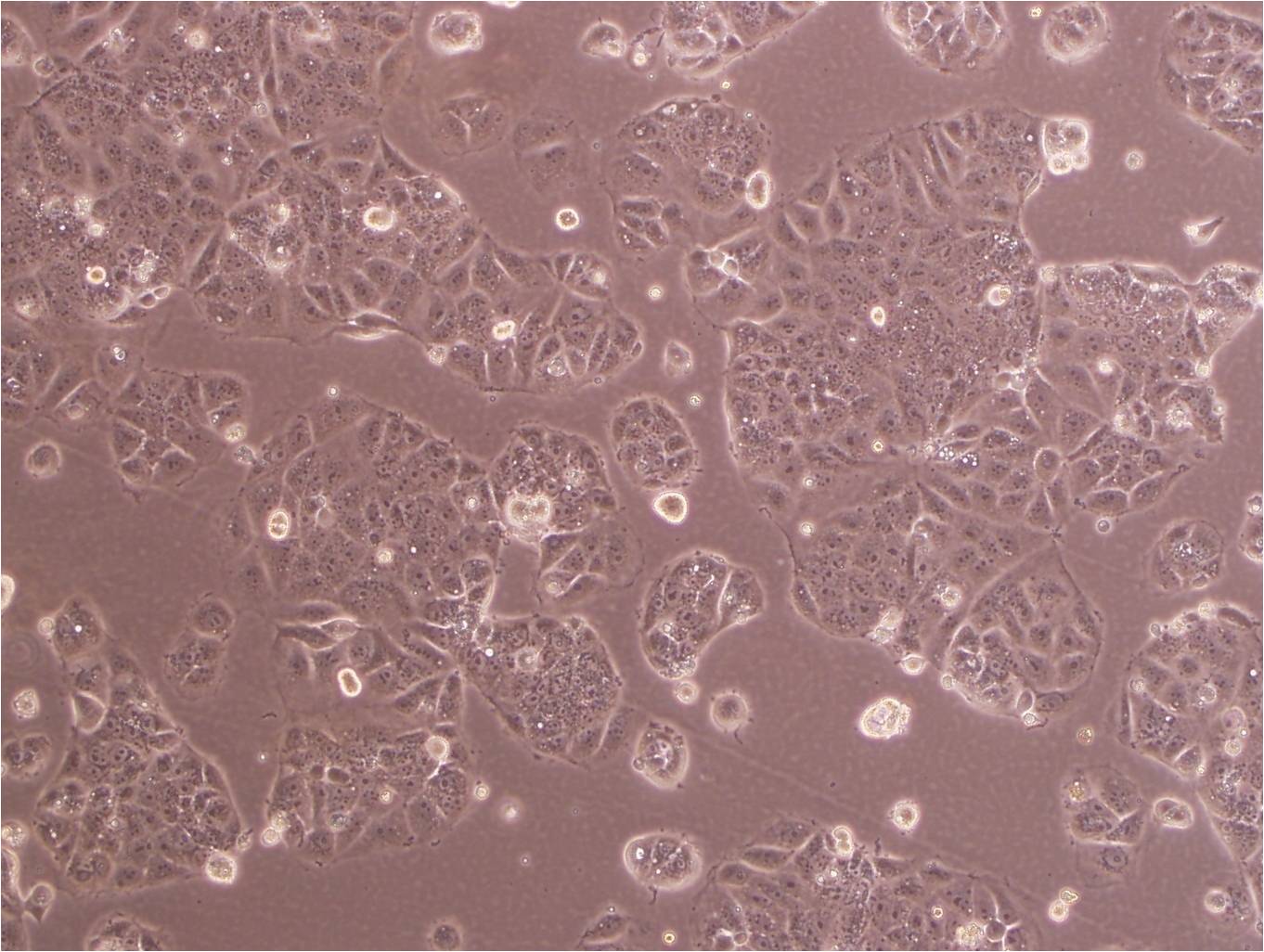 HCCLM3 epithelioid cells高轉(zhuǎn)移人肝癌細(xì)胞系,HCCLM3 epithelioid cells