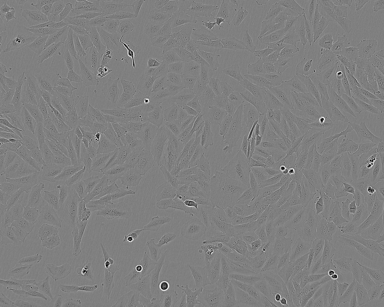TT epithelioid cells人甲状腺髓样癌细胞系,TT epithelioid cells