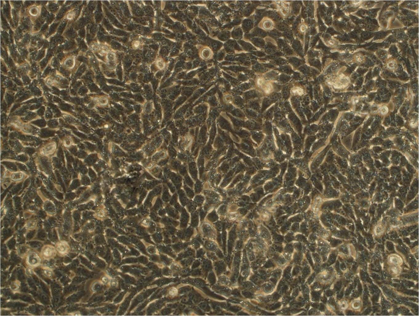 SW579 epithelioid cells人甲状腺鳞癌细胞系,SW579 epithelioid cells