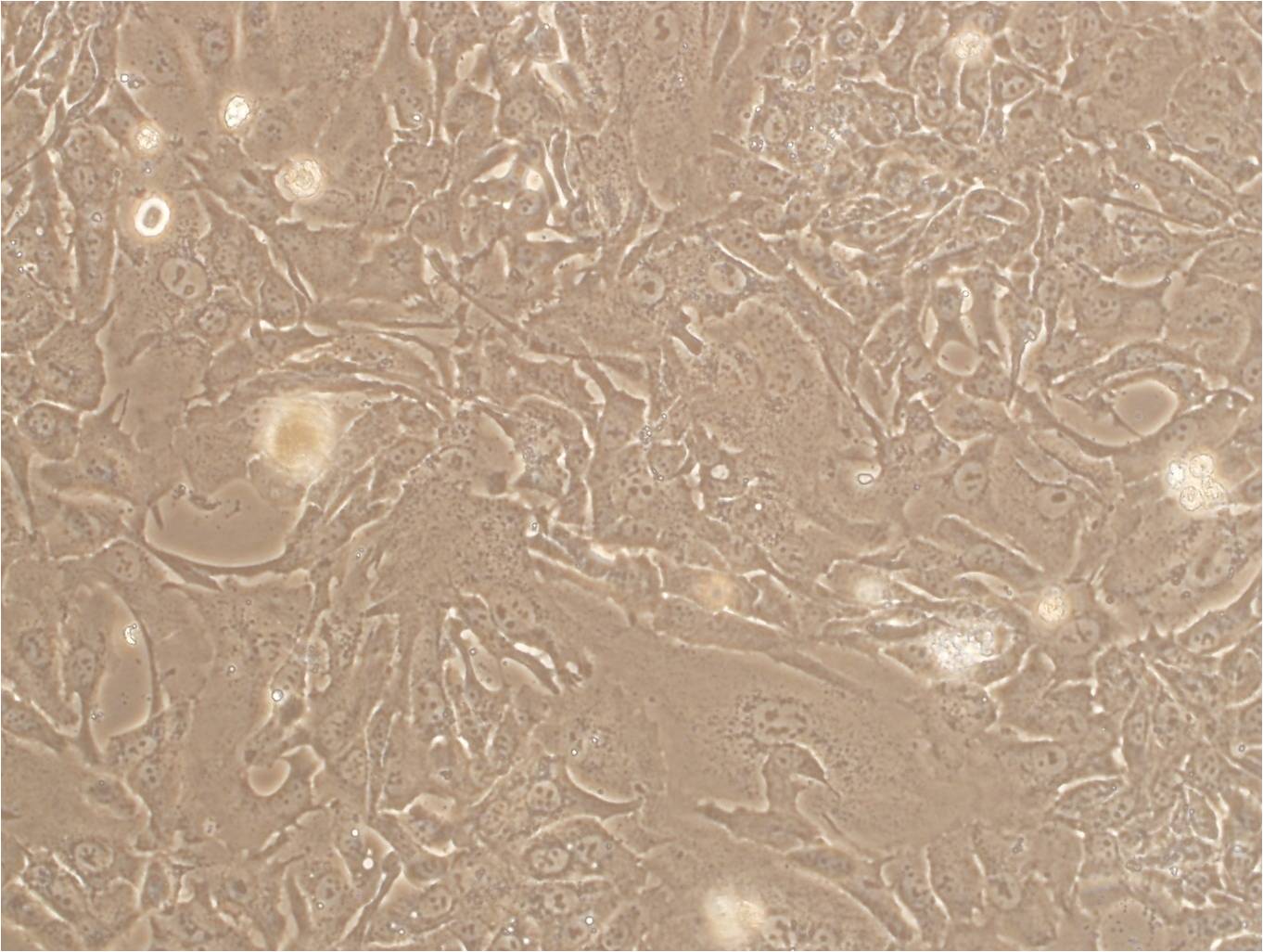 ES-2 epithelioid cells人卵巢癌细胞系,ES-2 epithelioid cells