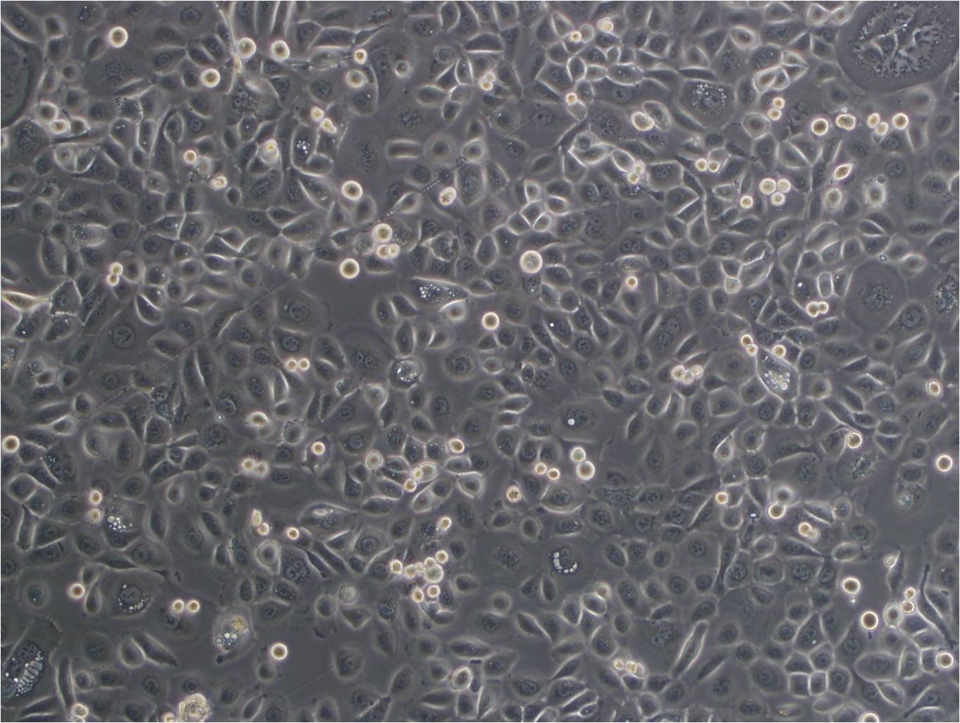 UM-UC-3 epithelioid cells人膀胱移行癌细胞系,UM-UC-3 epithelioid cells