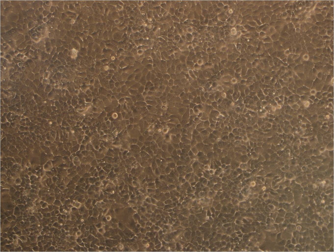 HTR-8 epithelioid cells人滋养细胞系,HTR-8 epithelioid cells