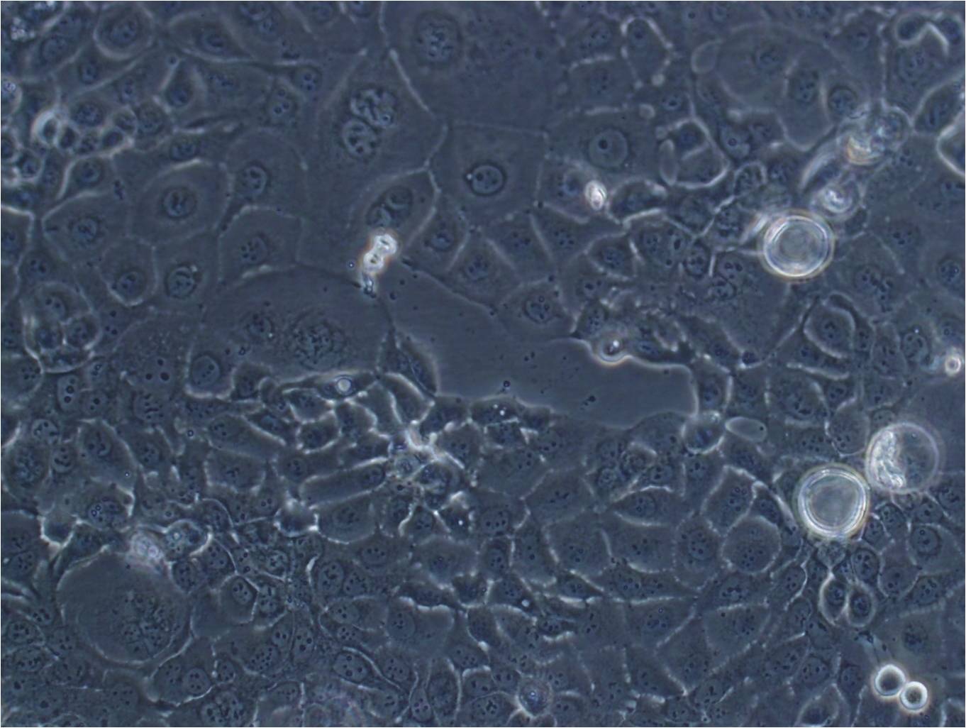 MDA-MB-415 epithelioid cells人乳腺腺癌细胞系,MDA-MB-415 epithelioid cells