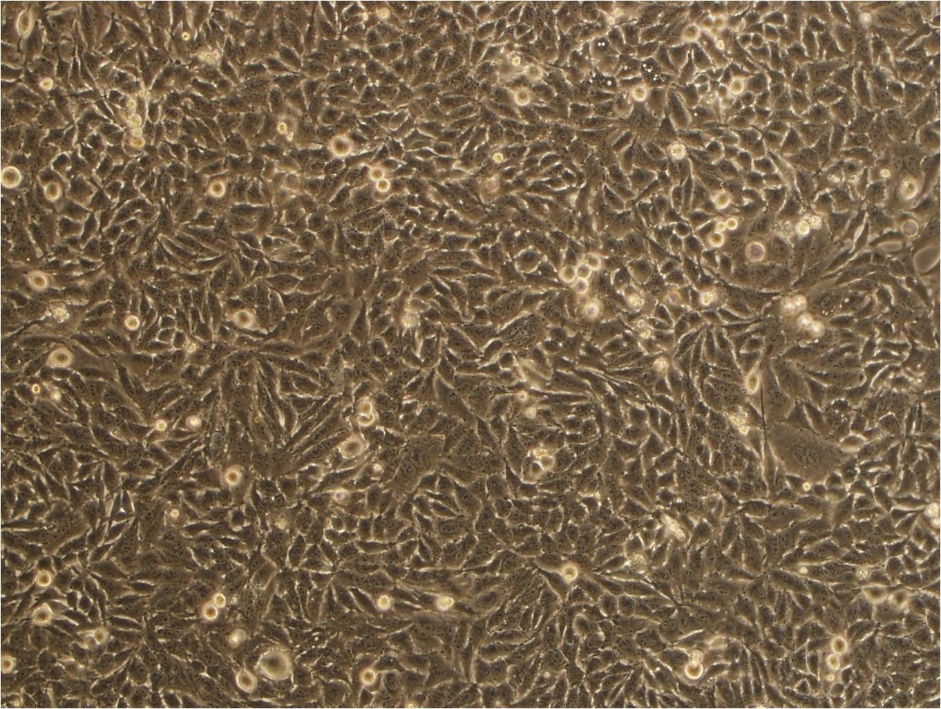 BT-549 epithelioid cells人乳腺导管癌细胞系,BT-549 epithelioid cells