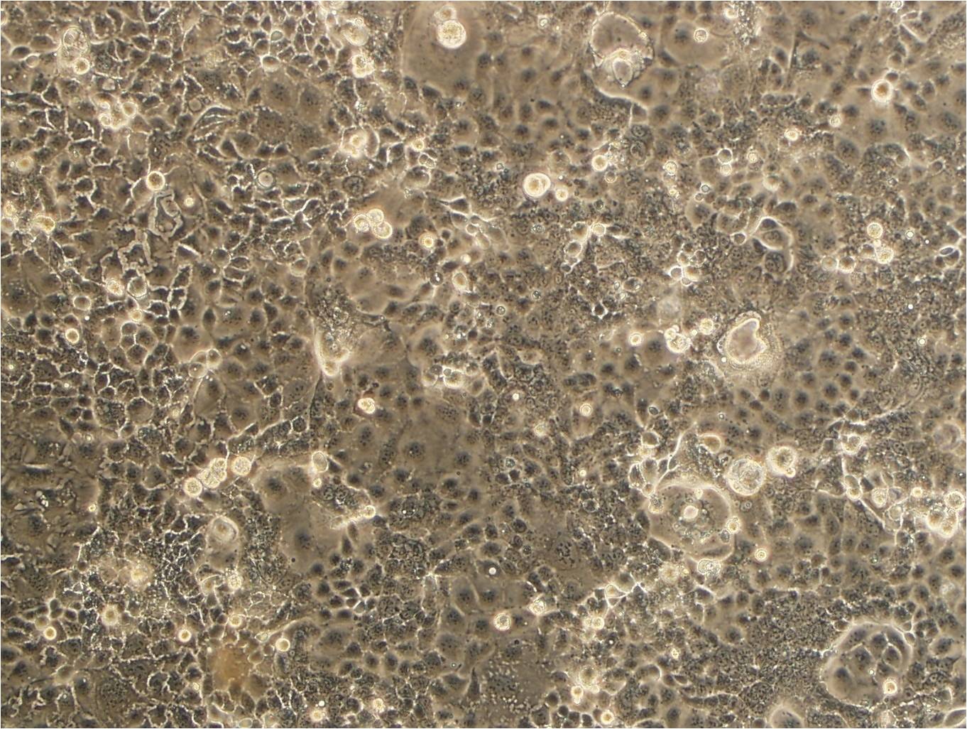 NCI-N87 epithelioid cells人胃癌细胞系,NCI-N87 epithelioid cells