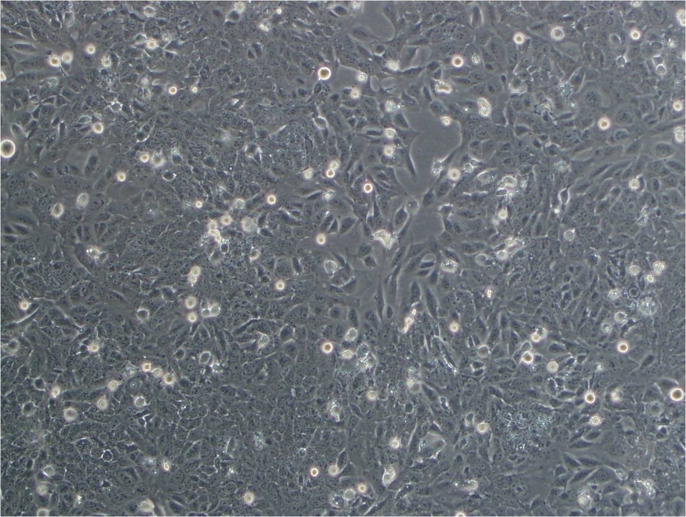 PL45 epithelioid cells人胰腺导管腺癌细胞系,PL45 epithelioid cells