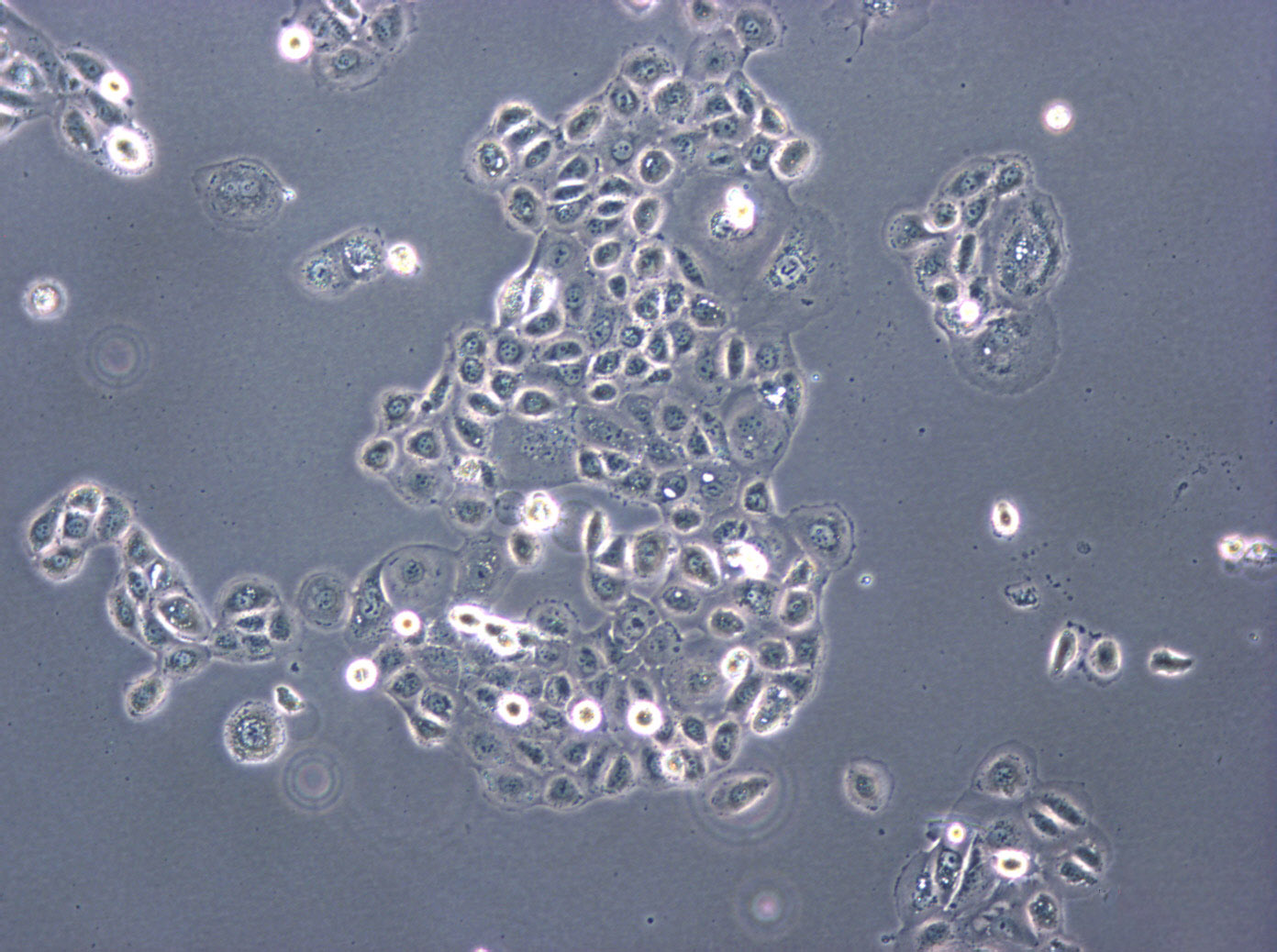 RL95-2 epithelioid cells人子宫内膜癌细胞系,RL95-2 epithelioid cells
