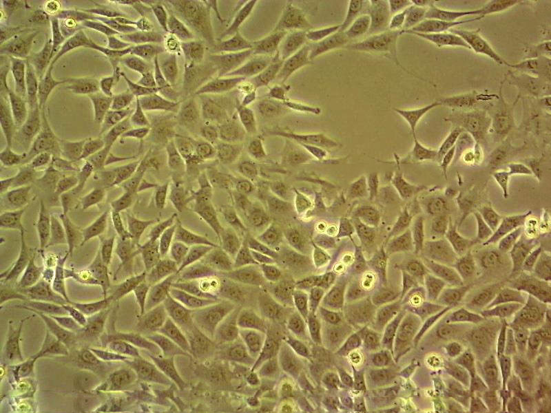 KLE epithelioid cells人子宫内膜癌细胞系,KLE epithelioid cells