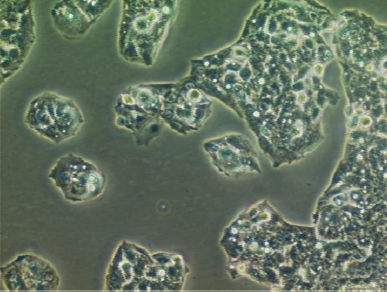 HEC-1-A epithelioid cells人子宫内膜癌细胞系,HEC-1-A epithelioid cells