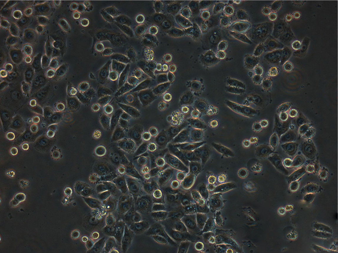 MS751 epithelioid cells人子宫颈表皮癌细胞系,MS751 epithelioid cells