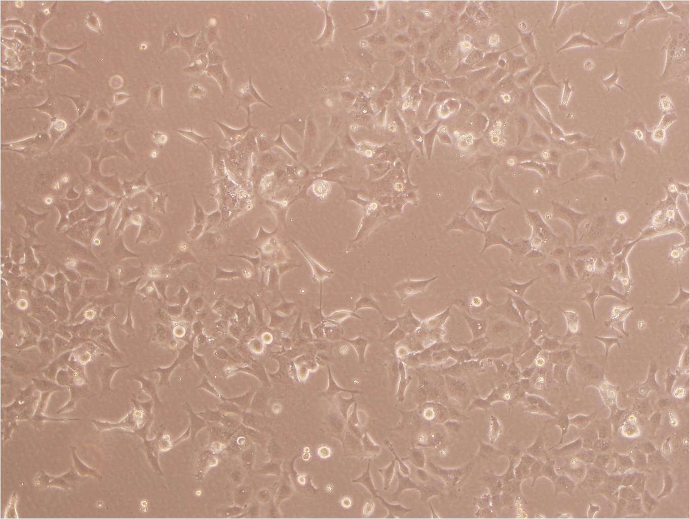 ME-180 epithelioid cells人子宮頸表皮癌細胞系,ME-180 epithelioid cells