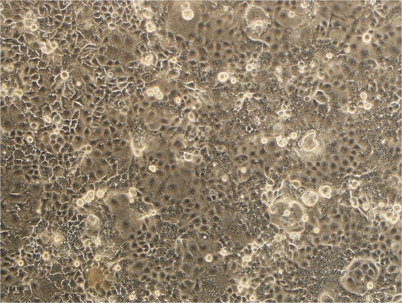 B16 epithelioid cells小鼠黑色素瘤細胞系,B16 epithelioid cells