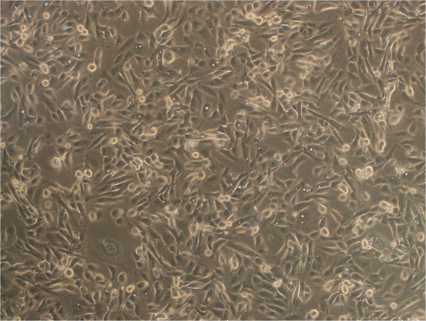 EOMA epithelioid cells小鼠血管内皮瘤细胞系,EOMA epithelioid cells