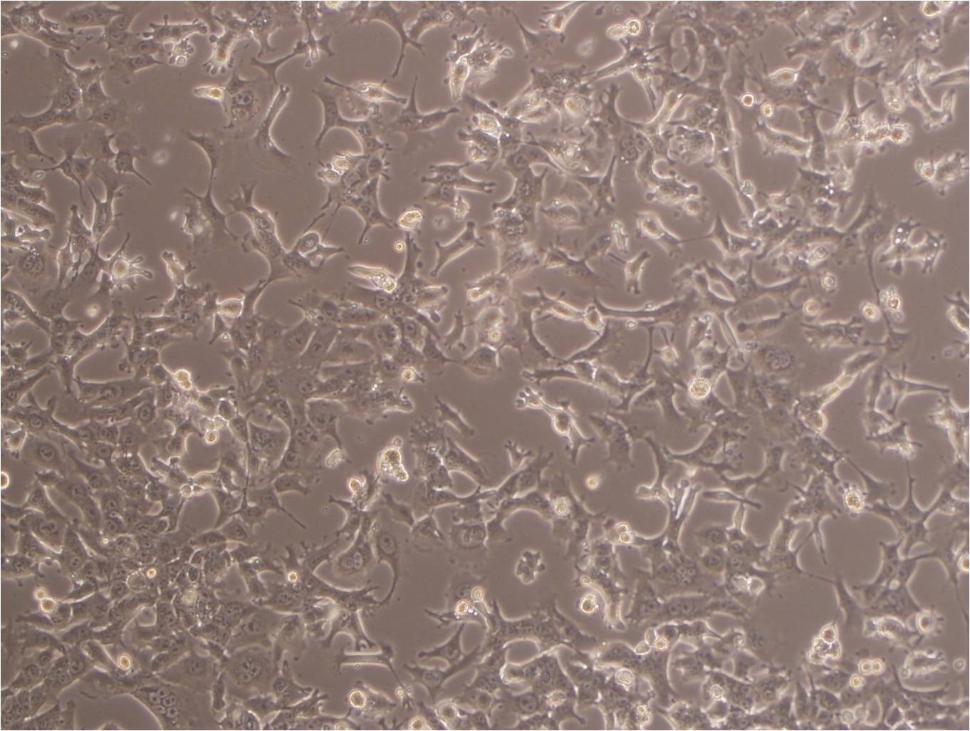 Beta-TC-6 epithelioid cells小鼠胰岛素瘤胰岛β细胞系,Beta-TC-6 epithelioid cells